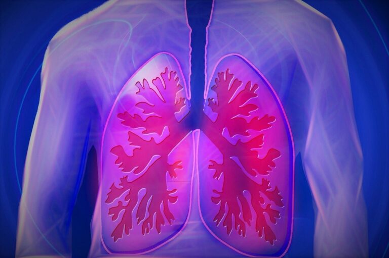 Casos de Tuberculosis en Aumento