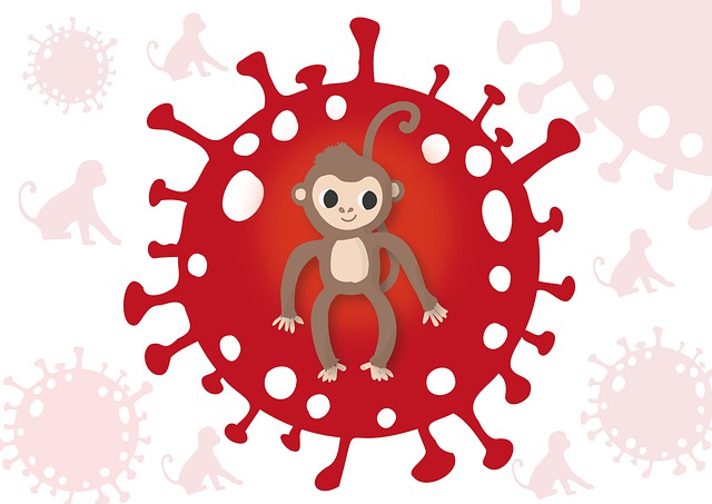 El estado de Washington informa el primer caso confirmado de viruela del mono