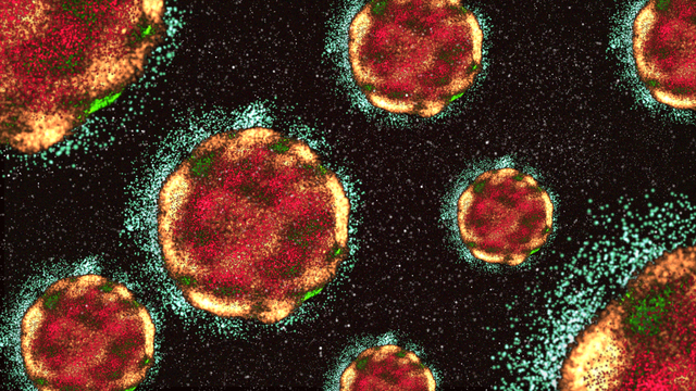 Los CDC advierten que el sarampión se está extendiendo por EE. UU.